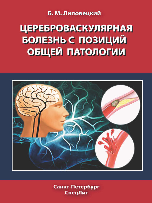 Cover image for Цереброваскулярная болезнь с позиций общей патологии
